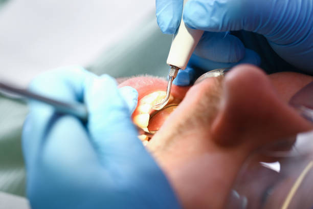 Best Emergency Treatment for Toothache in Glenarden, MD