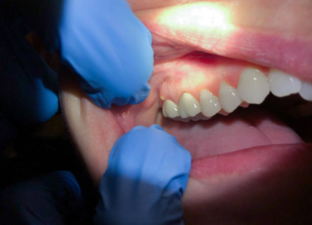 Best Emergency Dental Care for Trauma or Injury in Glenarden, MD